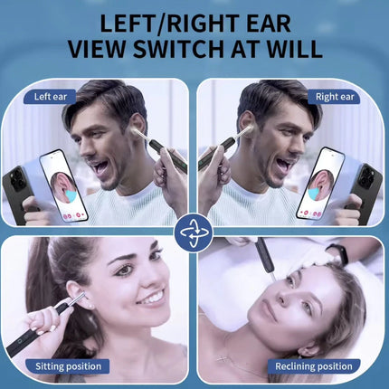Wireless Ear Wax Cleaner with Camera Safe Earwax Removal Endoscope